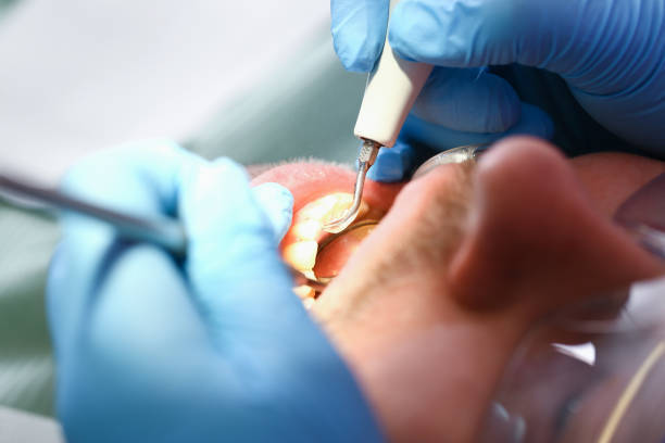 Best Emergency Dental Services for Seniors in Setauket, NY